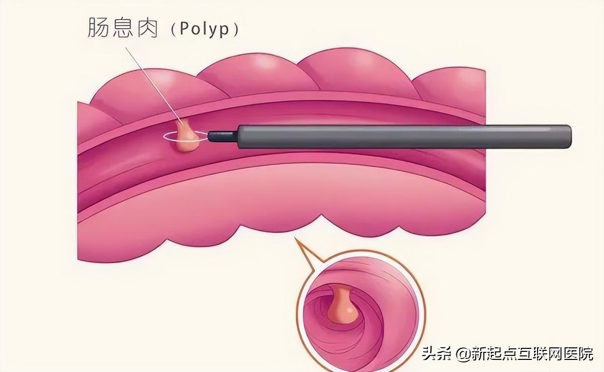 西甲硅油_西甲硅油_西甲硅油